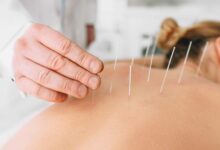 Why People Use Professional Acupuncture For Immediate Relief?